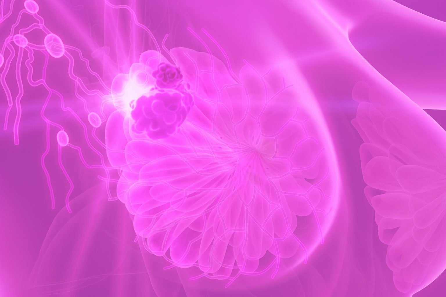 Causes of Breast Cancer