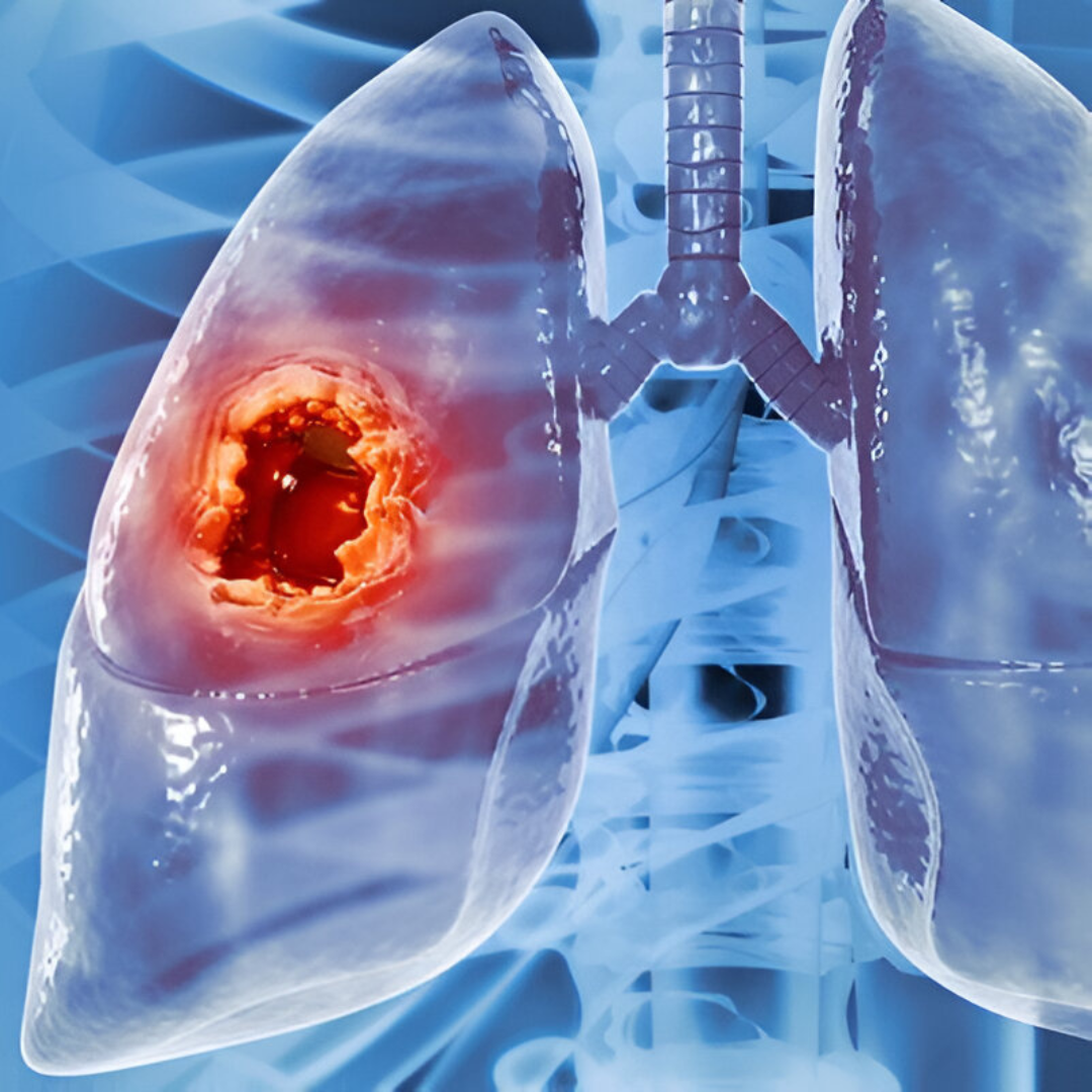 Illustration of Human Lungs